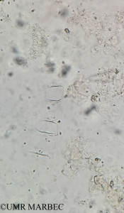 phyto/Brazilian_Amazon_coast/Amazomix_station_6/AMAZOMIX September 2021/Climacodium frauenfeldianum (Am_st6_R2_SURF a indentificar)(copy)_thumb.jpg